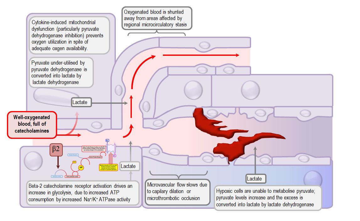 diagram of lactic acidosis in sepsis