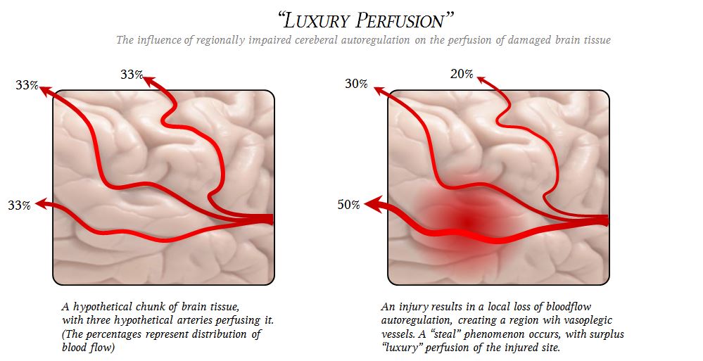 luxury perfusion