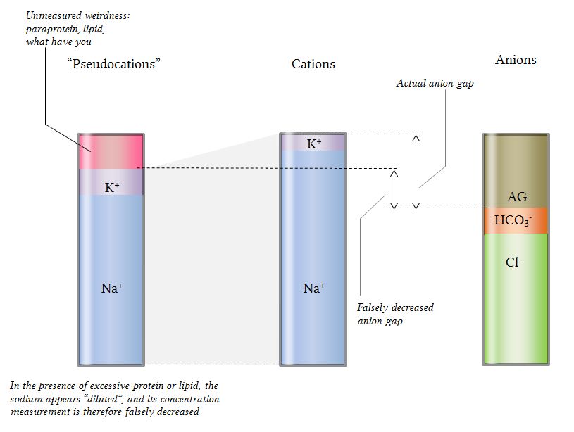 anion gap in pseudohyponatremia