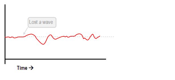 CVP loss of a waves in AF