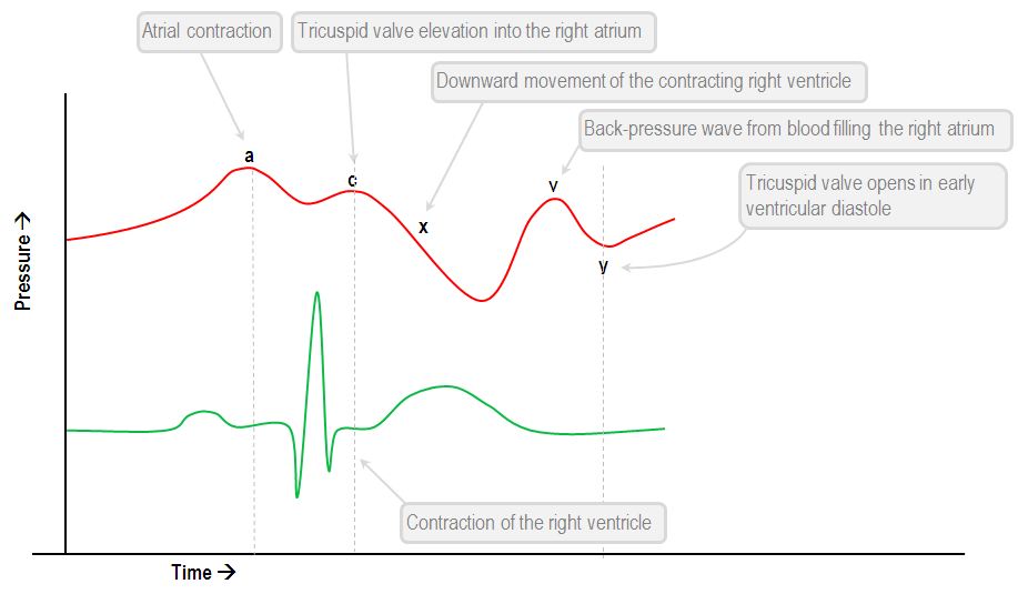 CVP normal waveform