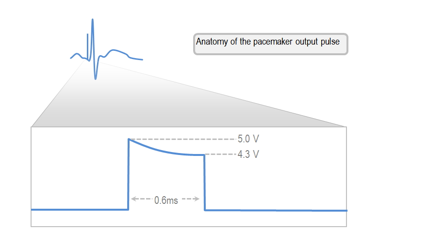 anatomy of the pacemaker output pulse