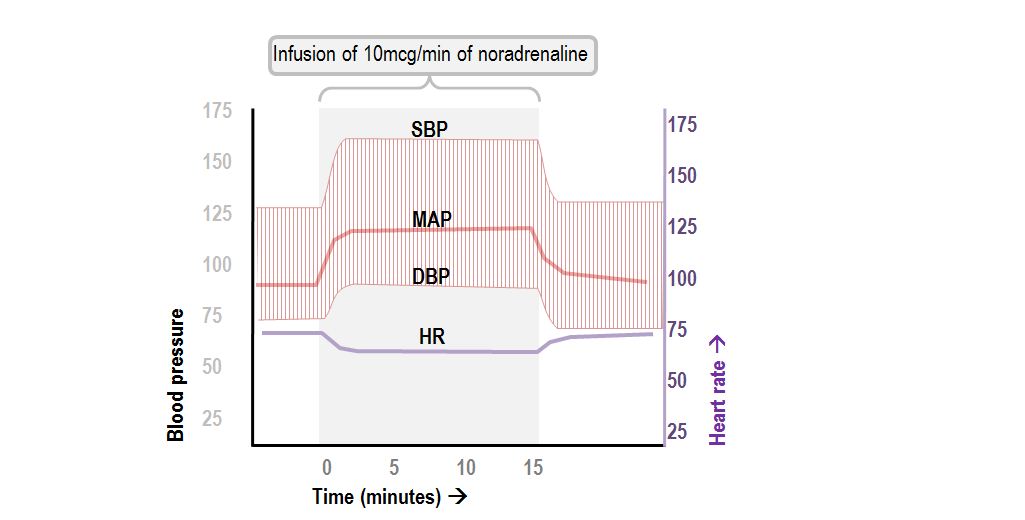 hemodynamic effects of noradrenaline infusion