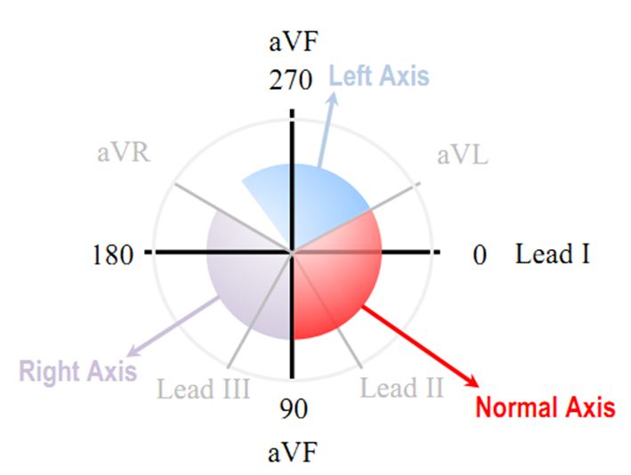 the QRS axis