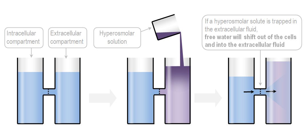 hyperosomolar hypernatremia