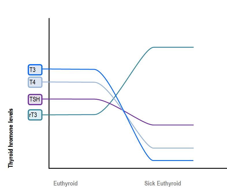 thyroid hormone levels in sick euthyroid syndrome