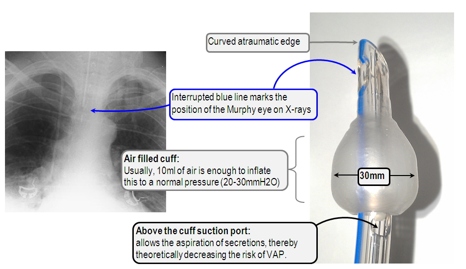 Anaomy of the ETT cuff