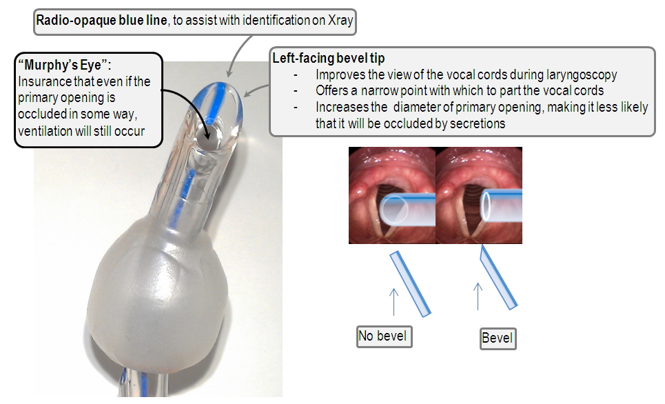 Anatomy of Murphy's eye and the ETT bevel