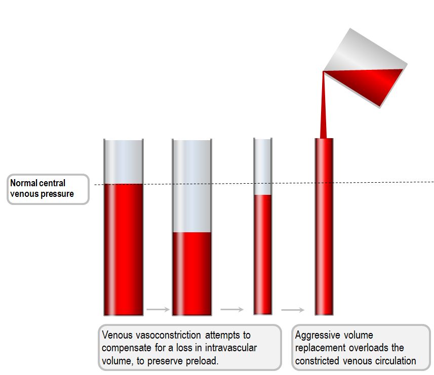 transfusion-associated circulatory overload