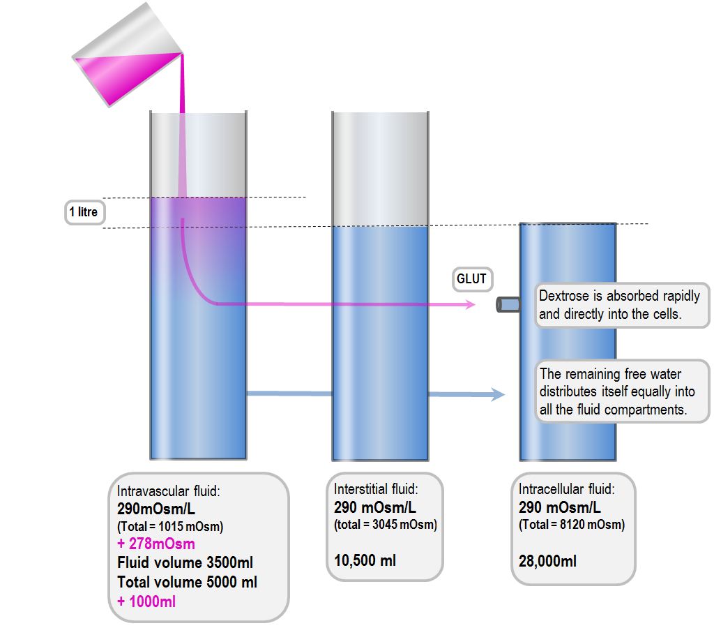 the infusion of 1 litre of 5% dextrose