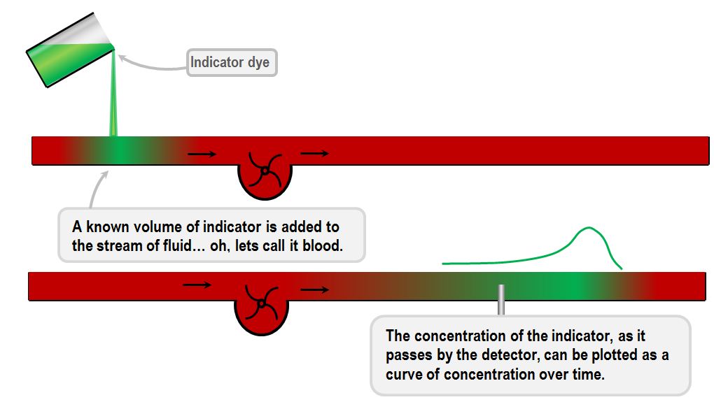 dye dilution measurement of cardiac output