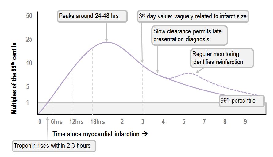 Normal troponin levels: Healthy ranges and what high levels mean