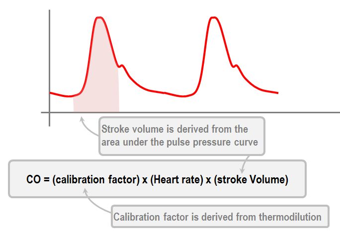 pulse contour cardiac output