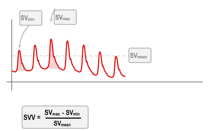 stroke volume variation
