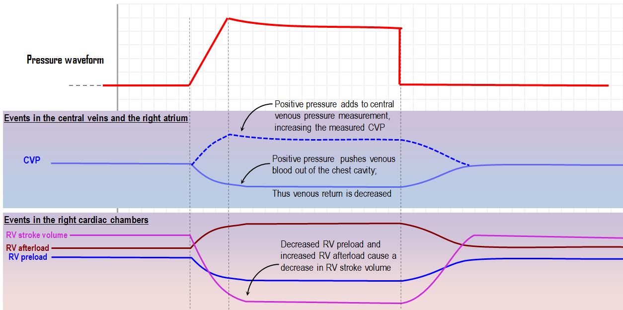 Hemodynamic response to a mechnical breath in the right heart
