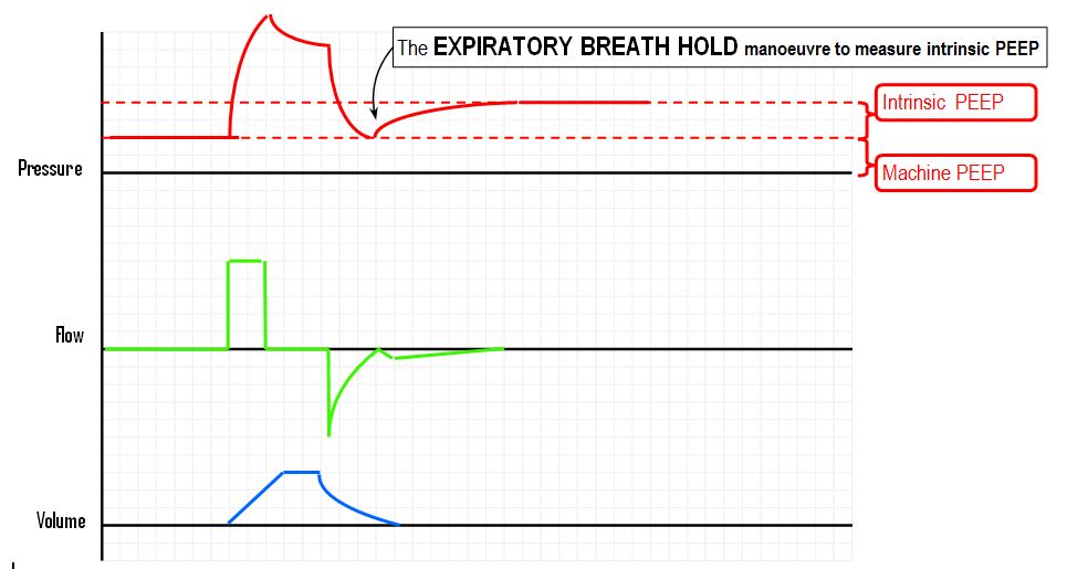 The expiratory hold manoeuvre