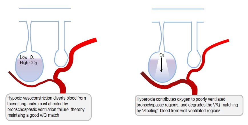 VQ mismatch in asthma due to hyperoxia 