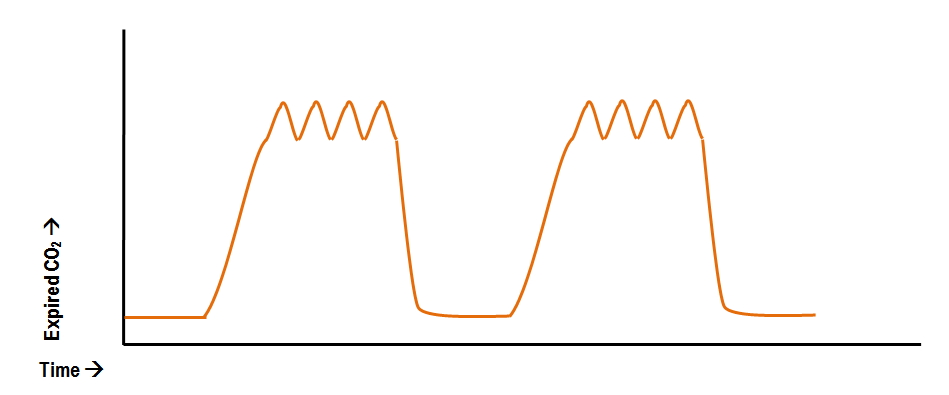 cardiac oscillations of the capnometer curve
