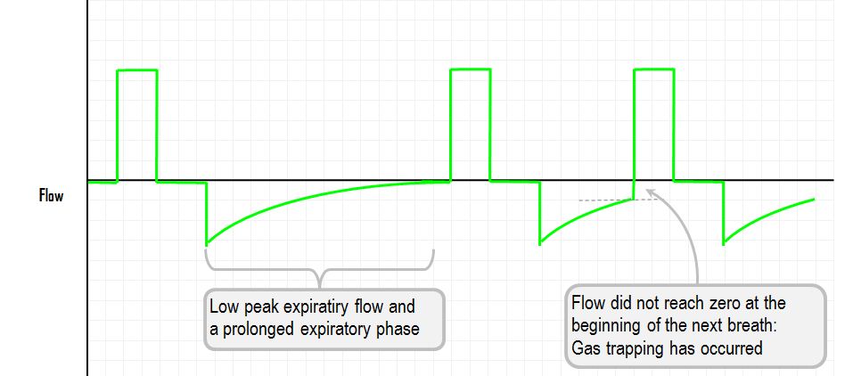 flow curves in increased airway resistance and gas trapping
