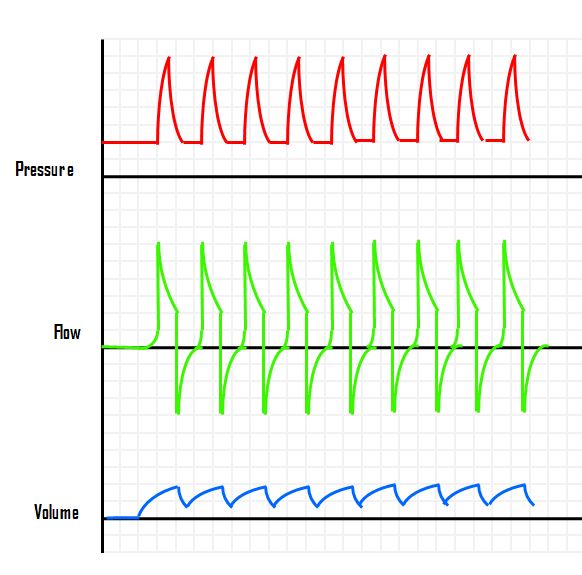 patient-ventilatory dyssynchrony – cardiac oscillations