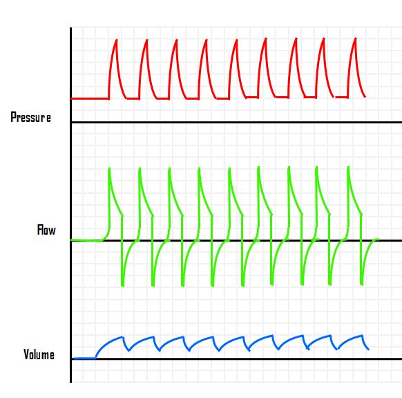 Patient-ventilator dyssynchrony