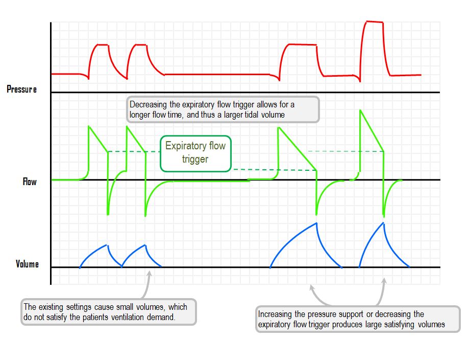 patient-ventilatory dyssynchrony – double triggering and premature breath termination