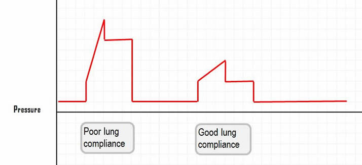 pressure corve in poor and in normal lung compliance