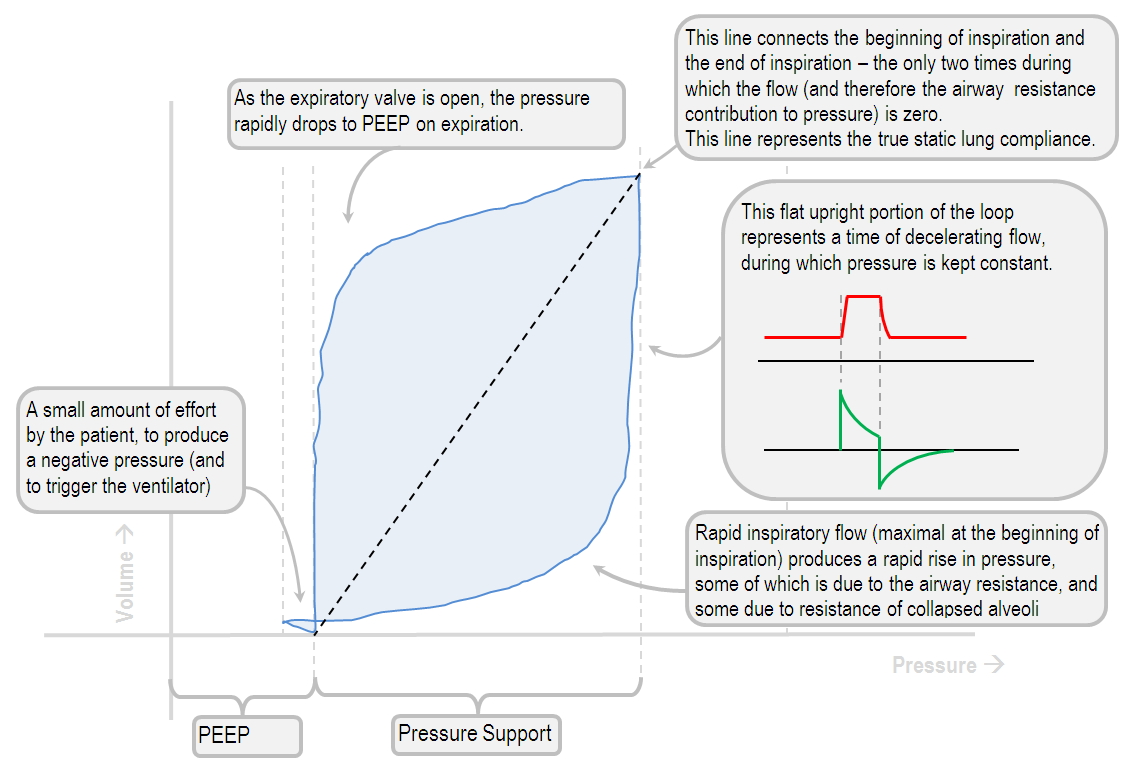 pressure volume loop in SIMV-PRVC