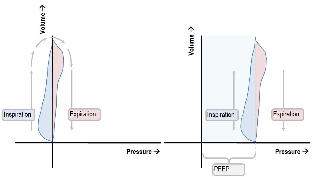 pressure volume loop in a spontaneously breathing patient