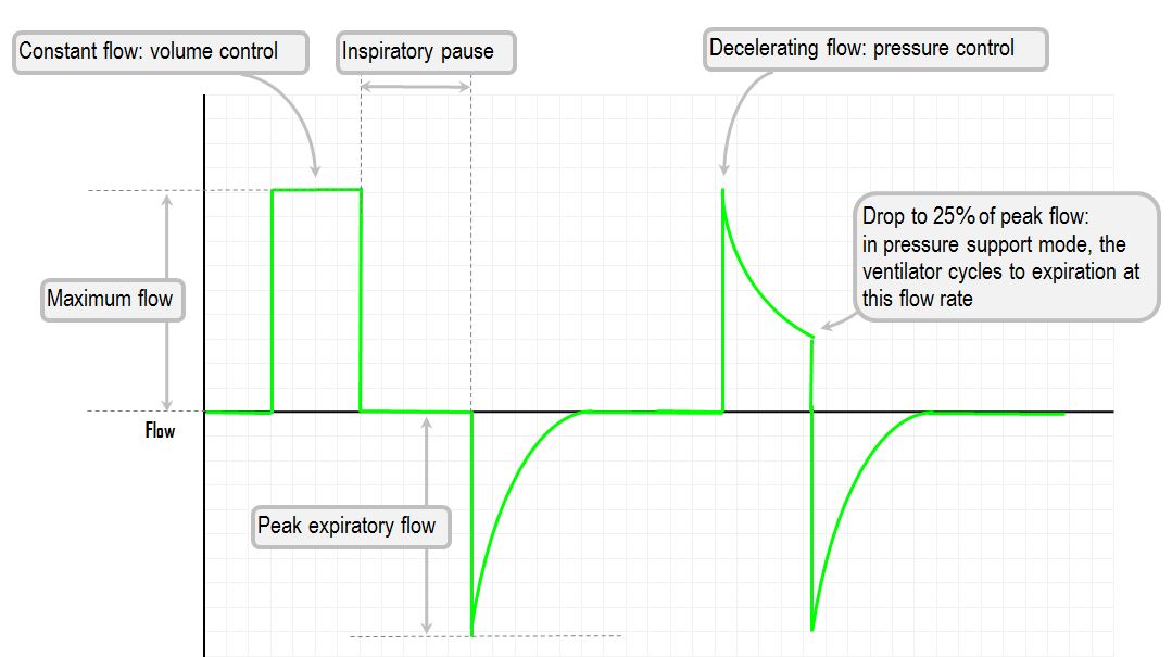 ventilator flow waveform
