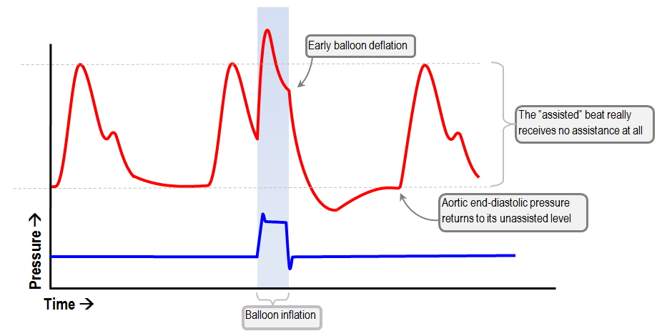 early IABP deflation fails to improve LV afterload