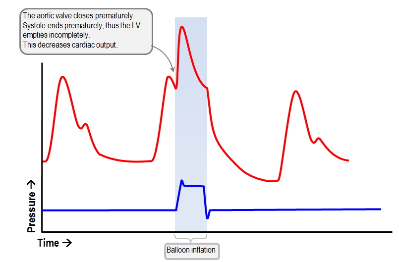 early IABP inflation increases afterload