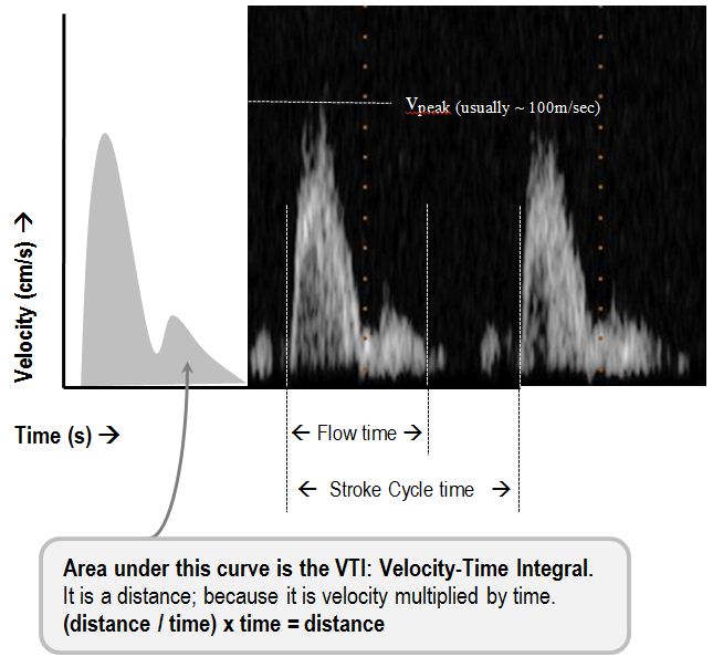pulse-wave aortic doppler