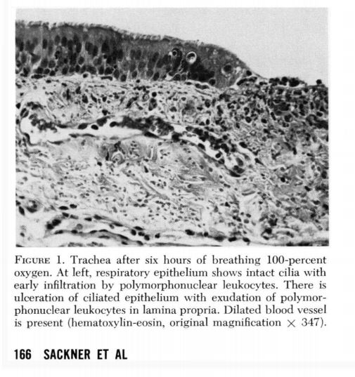 tracheboronchitis due to oxygen - Sackner et al 1976