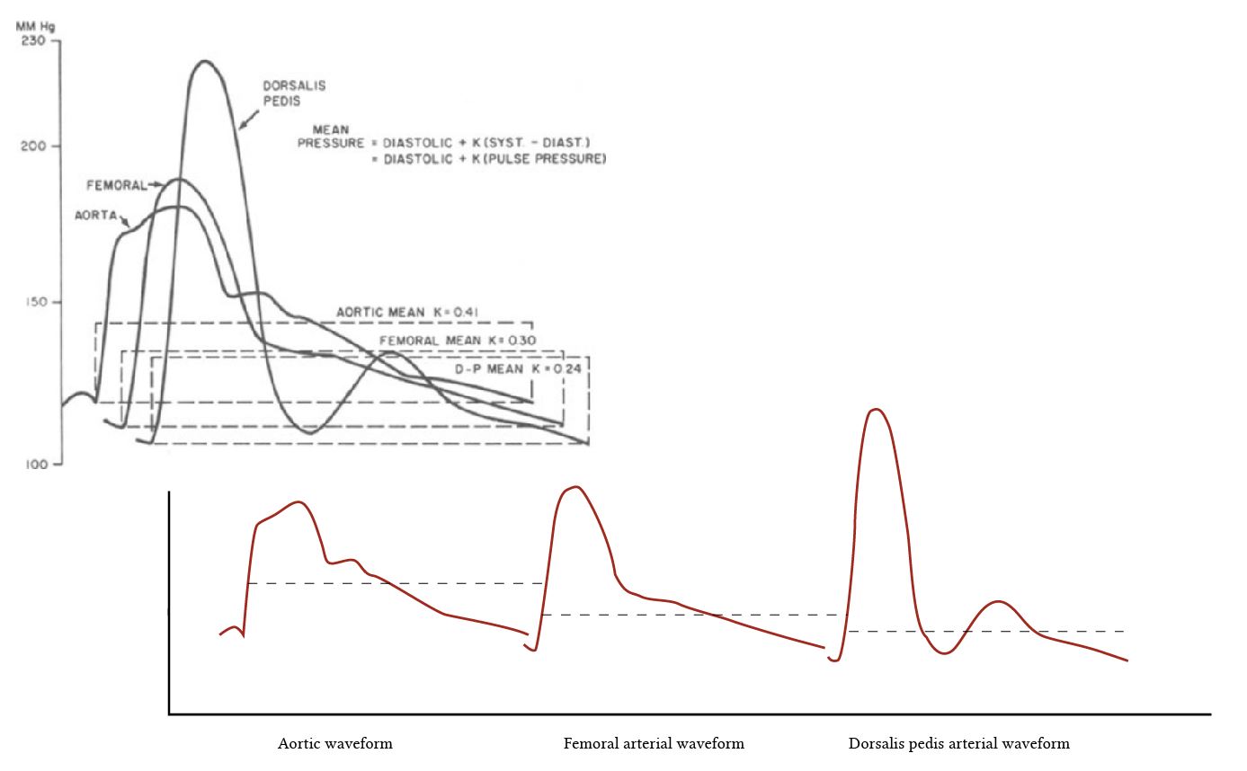 blood pressure waveforms in different vessels modified from Geddes et al.JPG