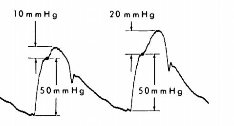 murgo et al effect of compressing peripheral arteries