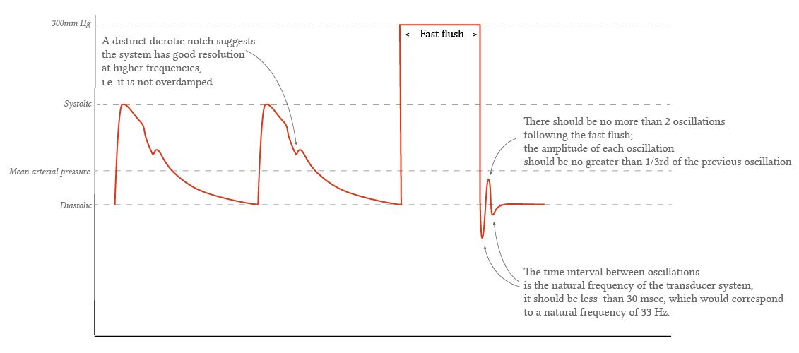 normal arterial line fast flush test for dynamic response testing