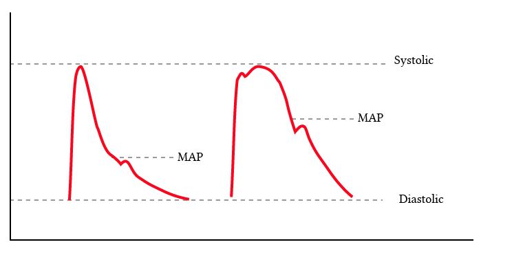 same systolic and diastolic, but different MAP