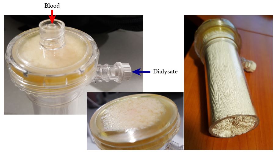 Anatomy of the dialysis filter