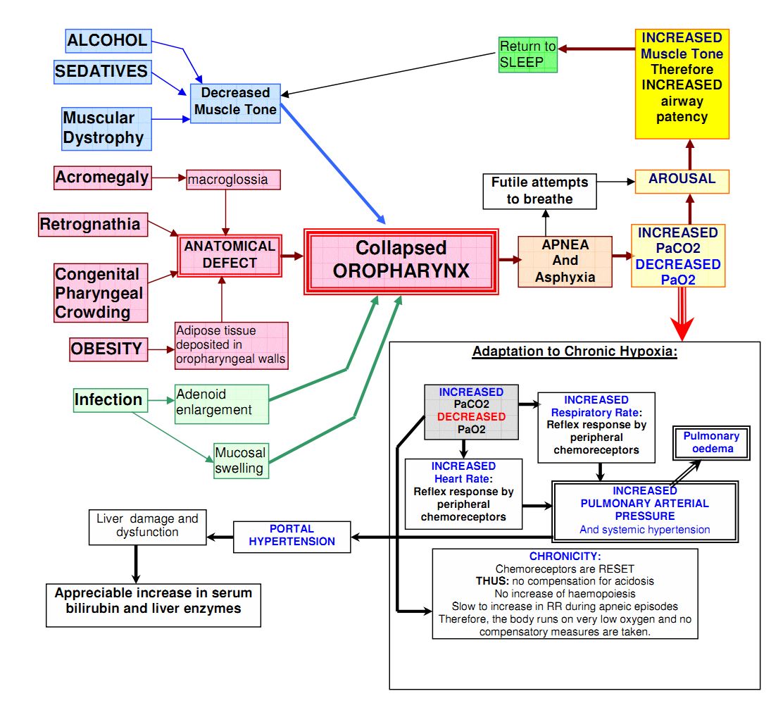 Obstructive sleep apnoea pathophysiology