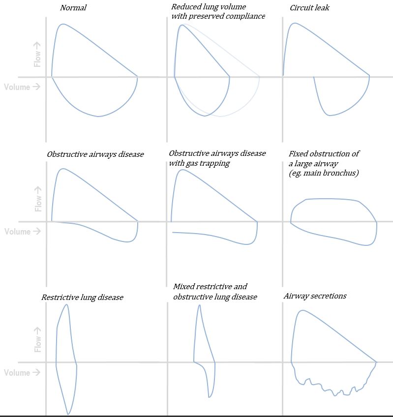 A brief summary of normal and abnormal flow volume loops