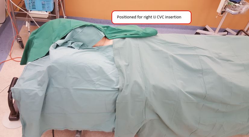 Mannequin draped for right IJ CVC insertion
