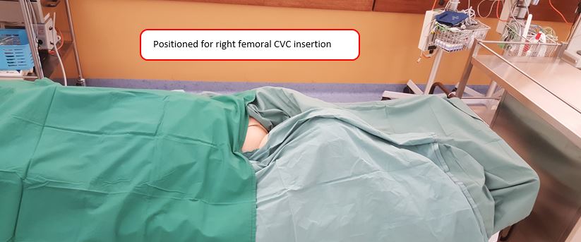 Mannequin draped for right femoral CVC insertion