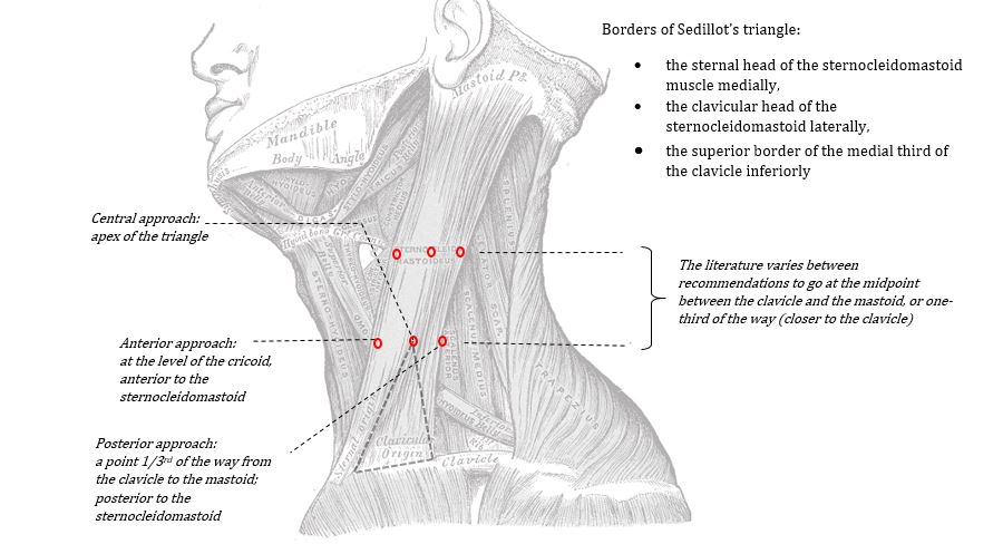 anterior central and posterior approached to IJ CVC insertion