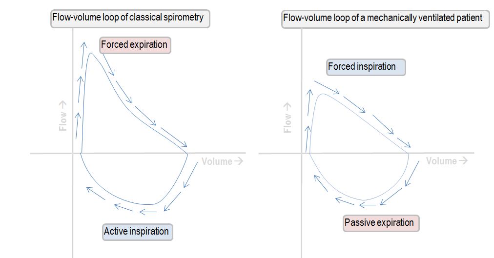 Interpreting the shape of the flow-volume loop | Deranged Physiology