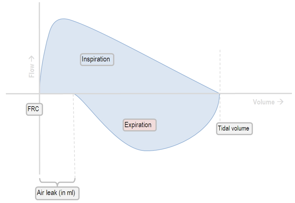 Flow-volume loop with a cuff leak